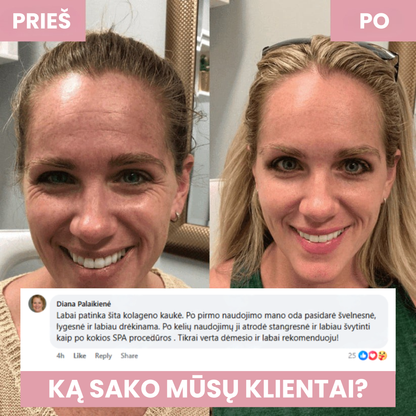 Kolageno apgaubiamoji naktinė kaukė
